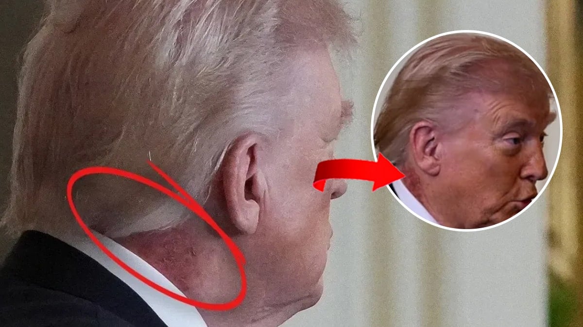 Dünyanın konuştuğu görüntüye Trump'ın doktorundan flaş açıklama