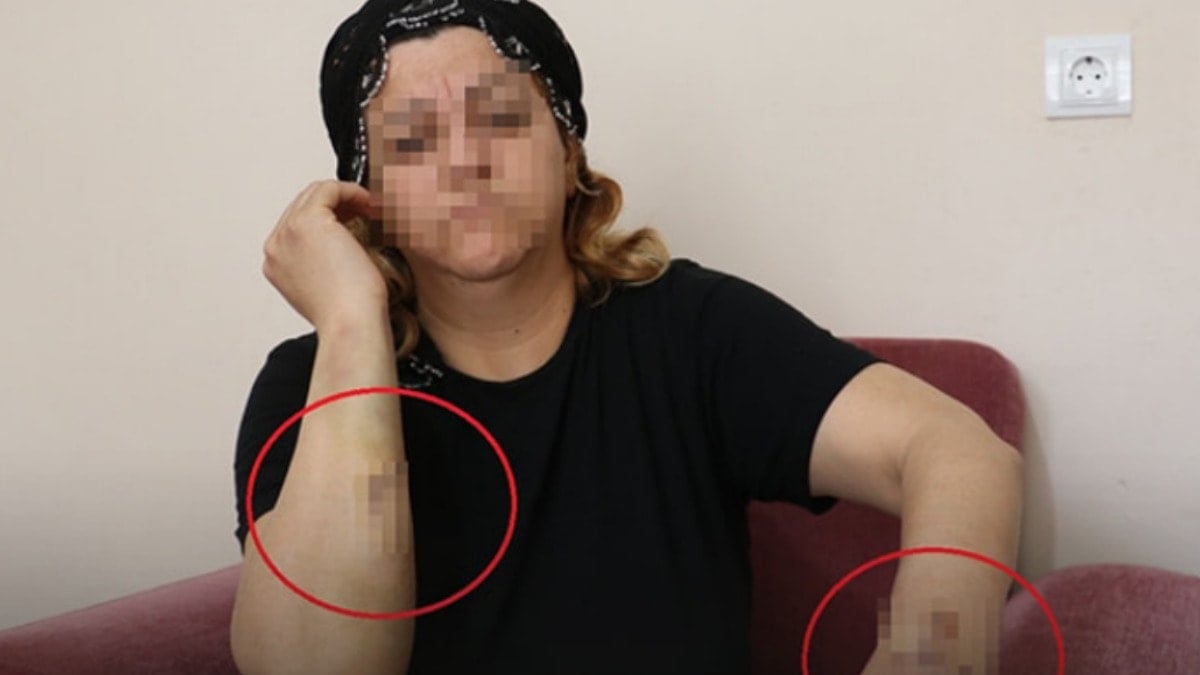 Diyarbakır’da kanlı pusu! Talihsiz kadını 30 yerinden bıçakladı