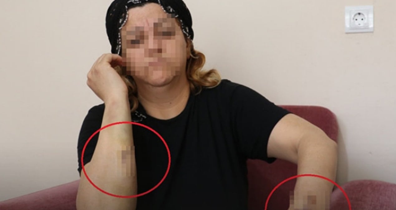 Diyarbakır’da kanlı pusu! Talihsiz kadını 30 yerinden bıçakladı