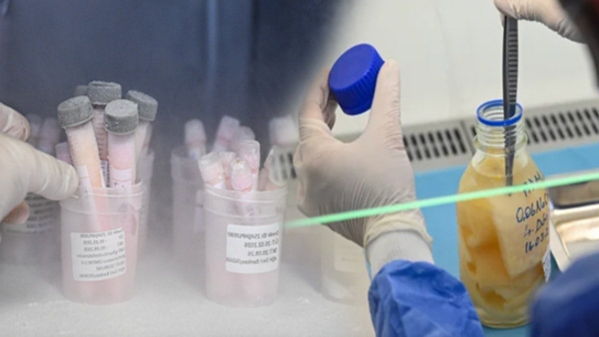 Ölen insanların derileri Türkiye'deki bu merkezde saklanıyor!