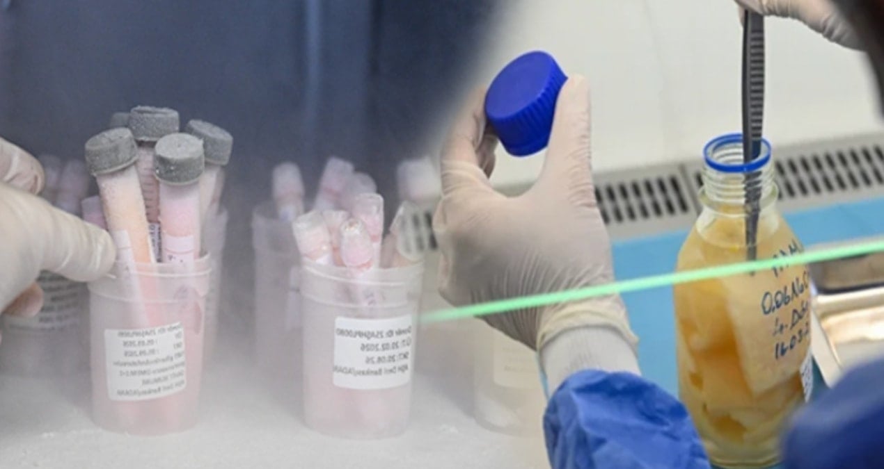 Ölen insanların derileri Türkiye'deki bu merkezde saklanıyor!