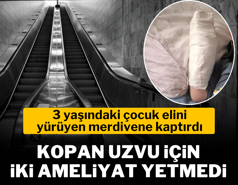 AVM'de yürüyen merdiven faciası; 3 yaşındaki çocuğun kopan parmağı kurtarılamadı