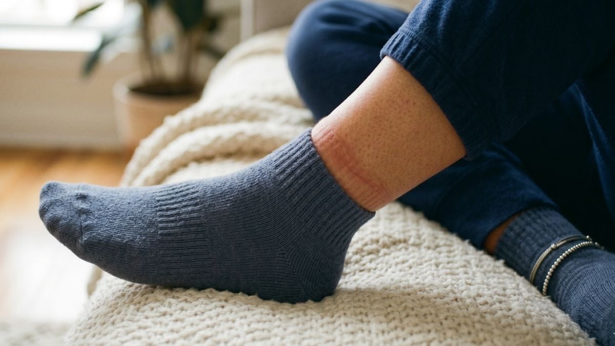 Bilekteki çorap izlerinin asıl sebebi buymuş