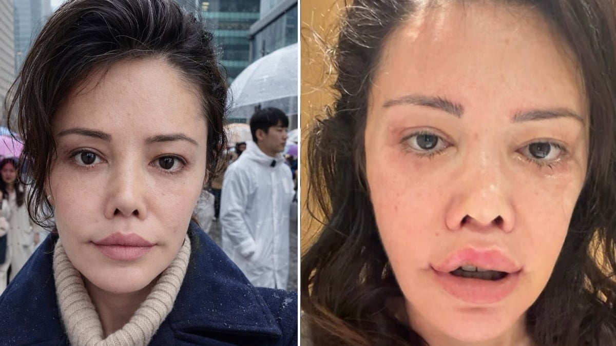 Kore’de yüz nakli olan Didem Ceran son halini paylaştı: ''Bebeksiliğim yapay zeka değil''