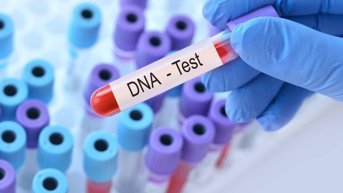 Karı koca eğlence olsun diye DNA testi yaptırdı: Korkunç aile sırrı ortaya çıktı
