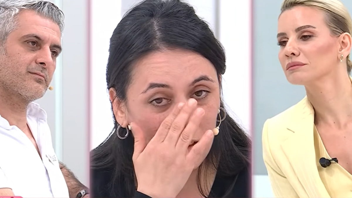 Eşi dişleri yüzünden hakaret ediyordu: Bambaşka bir görünüme kavuştu