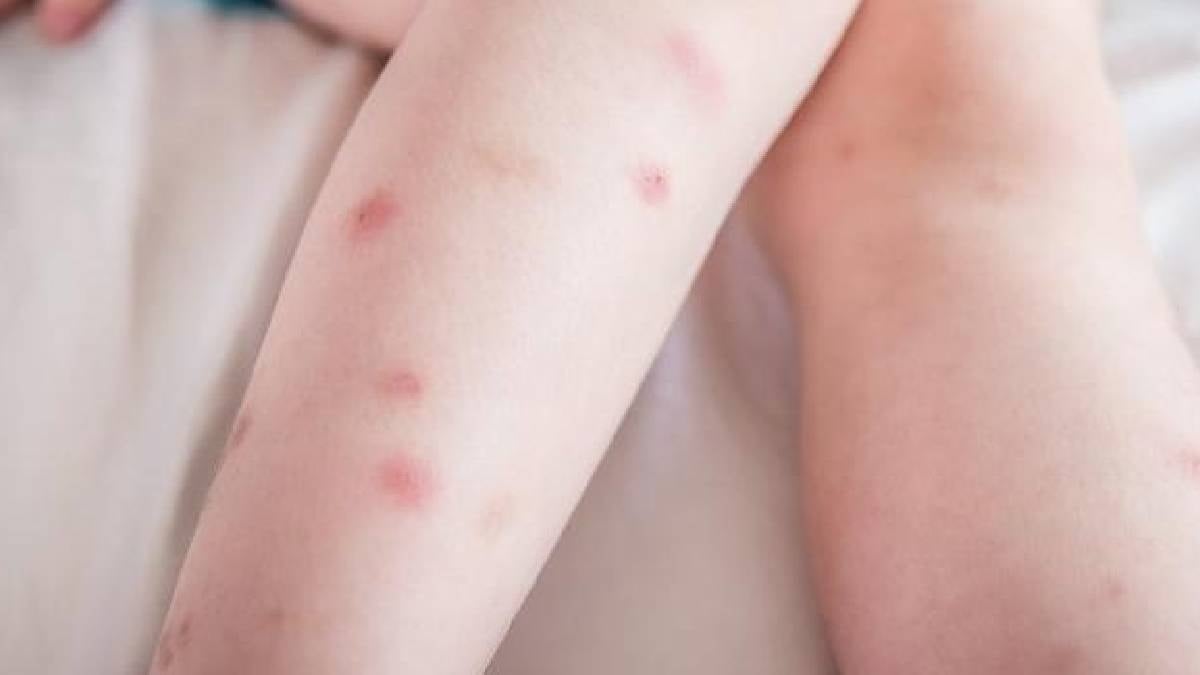 Dünyanın en acı veren ısırığı: Kurşundan daha etkili