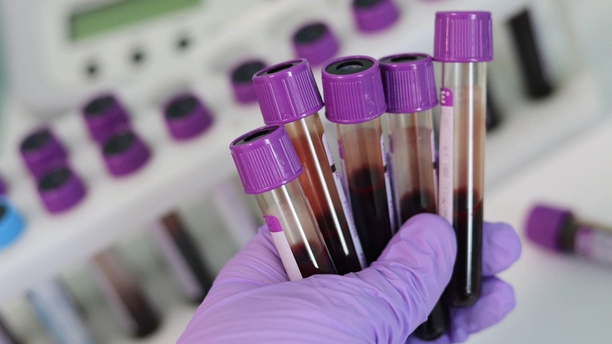 Bağışıklık sistemi en güçlü kan grubu belli oldu