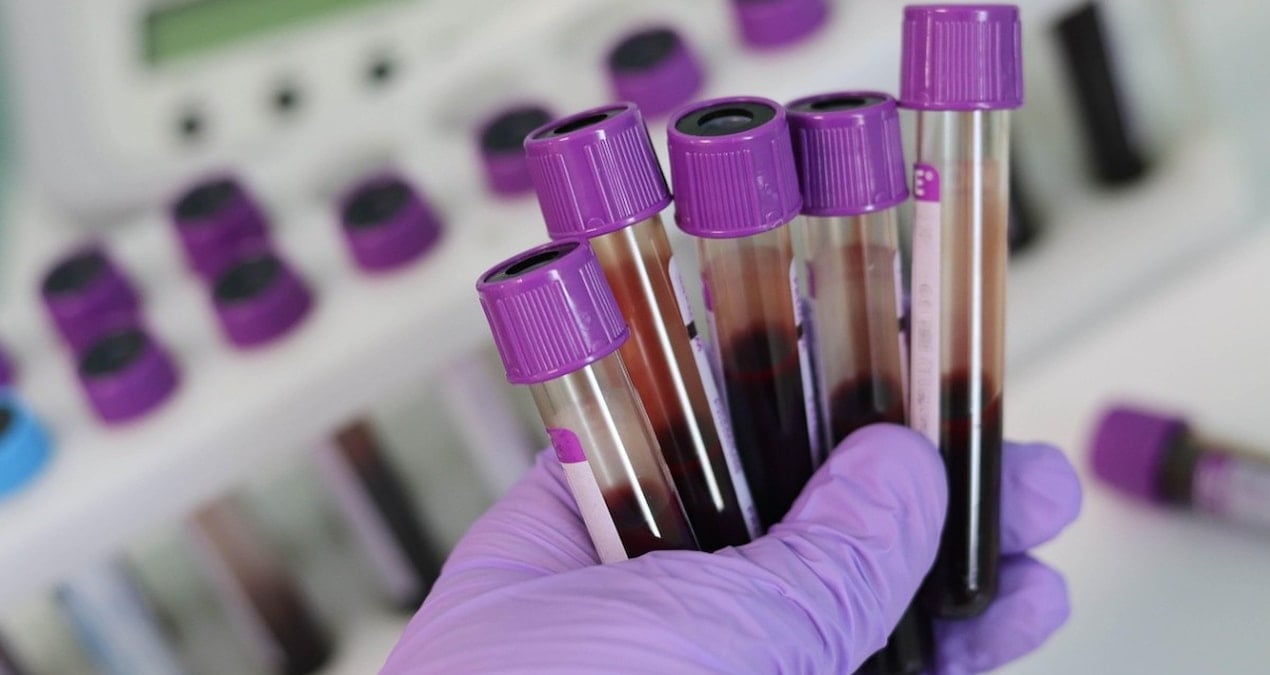 Bağışıklık sistemi en güçlü kan grubu belli oldu