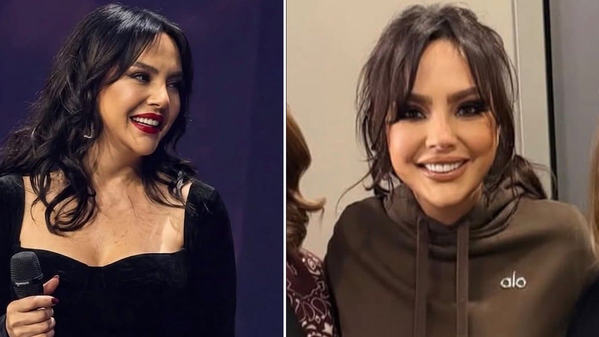 Yüzünü gerdirdi, 20 yaş gençleşti: Tek isteğini böyle anlattı