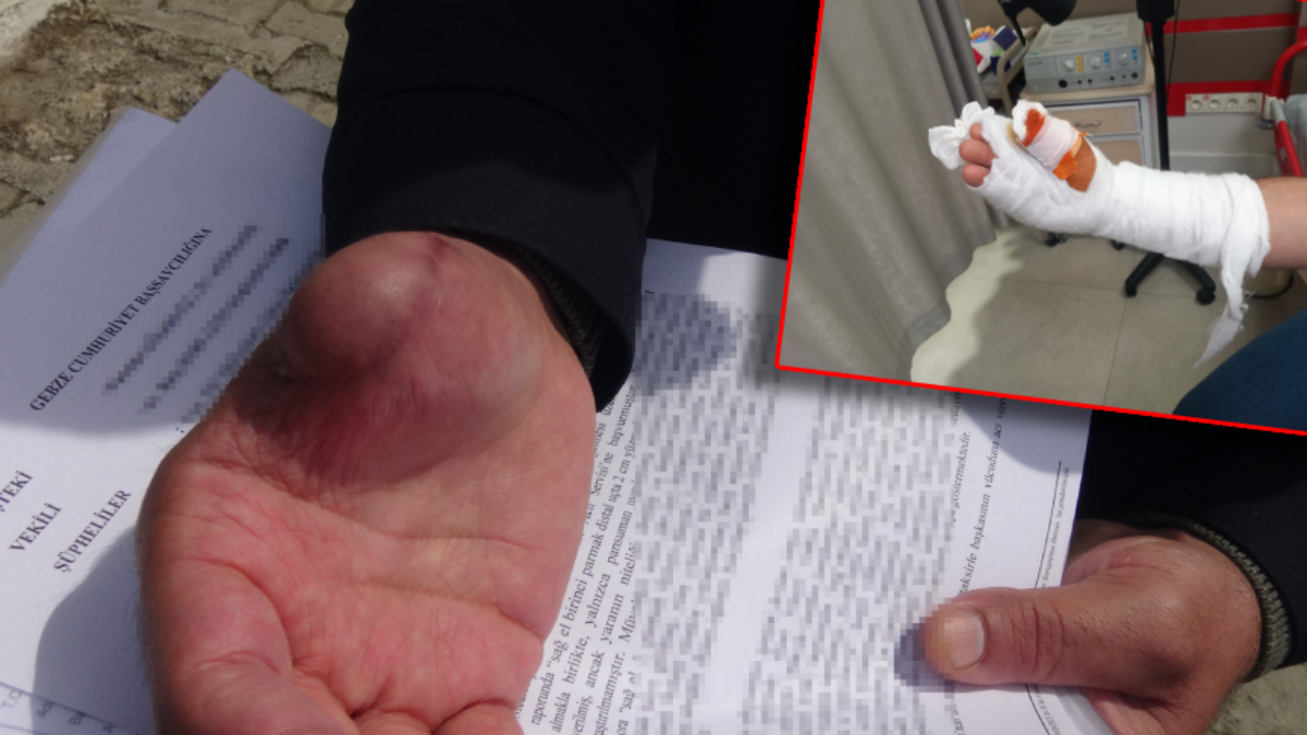 Bir kesikle hayatı karardı: 'Parmağım çürümeye başladı'