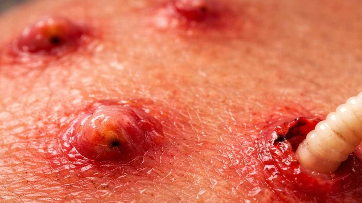 'Sivilce' zannetti, derisinin altından canlı canlı çıkardılar