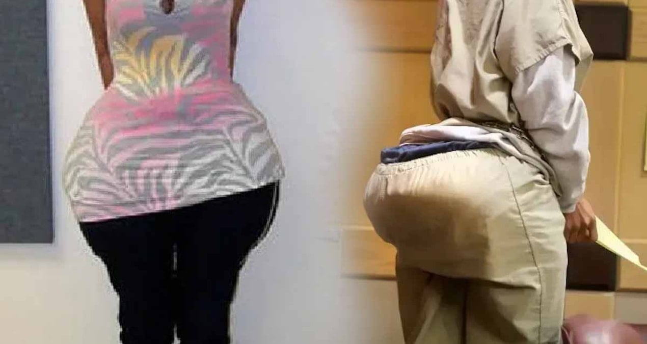 Dolgu diye kalçalarına çimento ve macun basmışlar