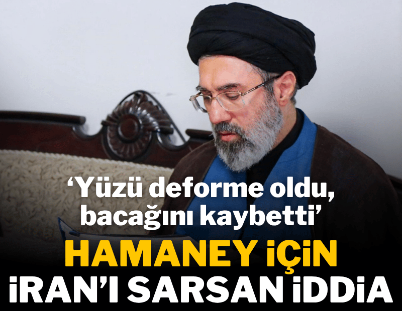 İran'ın dini lideri Mücteba Hamaney'e dair ciddi iddialar: Yüzü paramparça