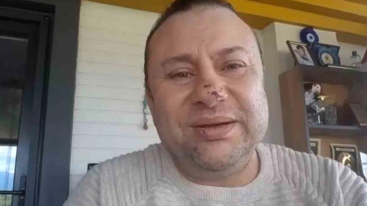 Pitbull saldırmıştı: Felaket Tellalı ile ilgili yeni gelişime