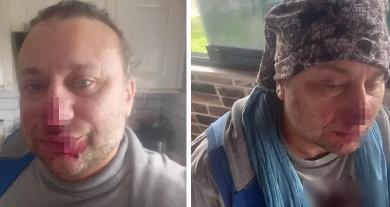 'Felaket Tellalı' Onur Akay entübe edildi iddiası