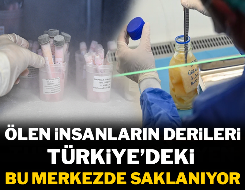 Ölen insanların derileri Türkiye'deki bu merkezde saklanıyor!