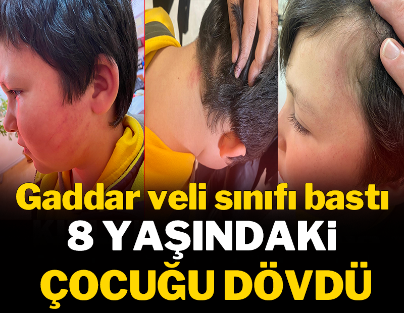 Gaddar veli sınıfı basıp 8 yaşındaki çocuğu dövdü!