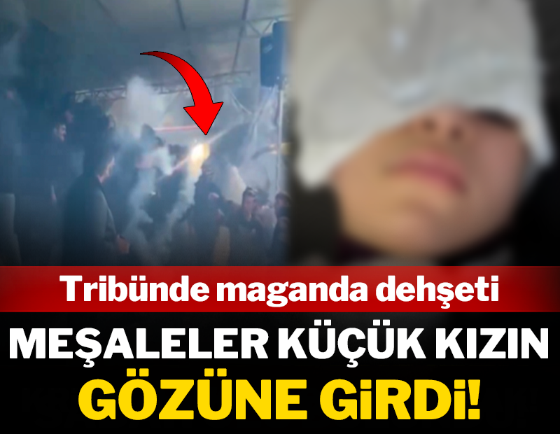 Tribünde maganda dehşeti: Meşale kız çocuğunun gözüne girdi!