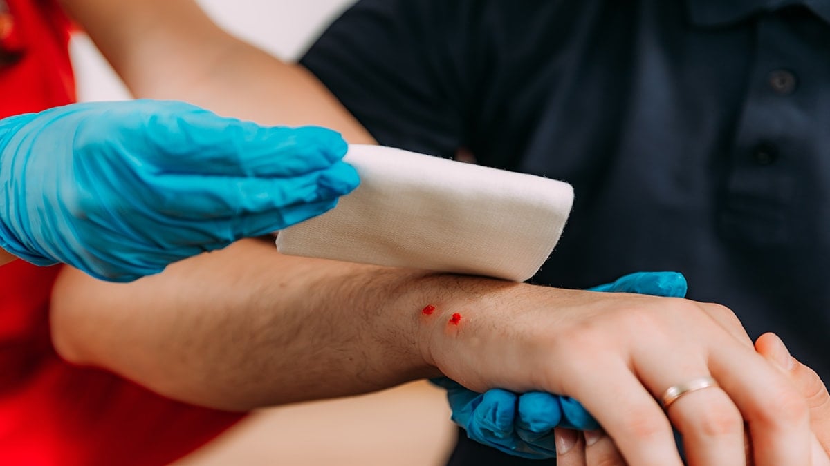 Yılan ısırmasında ilk yardım sandığınız şey aslında en büyük yanlışmış