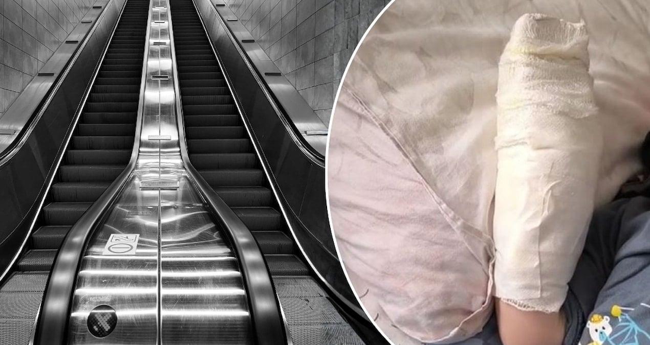 AVM'de yürüyen merdiven faciası; 3 yaşındaki çocuğun kopan parmağı kurtarılamadı