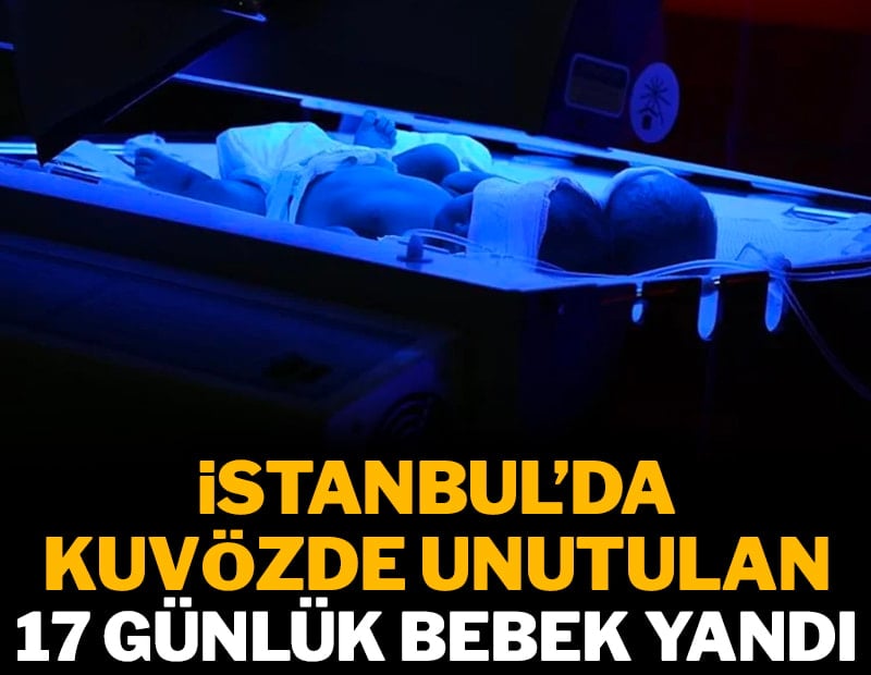 İstanbul'da kuvözde unutulan 17 günlük bebek yandı