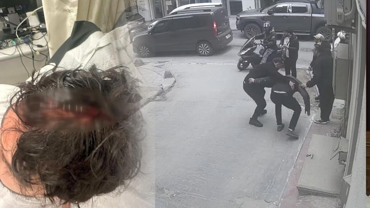 Yolda yürürken ölümden döndü: Kafasına 7 dikiş atıldı