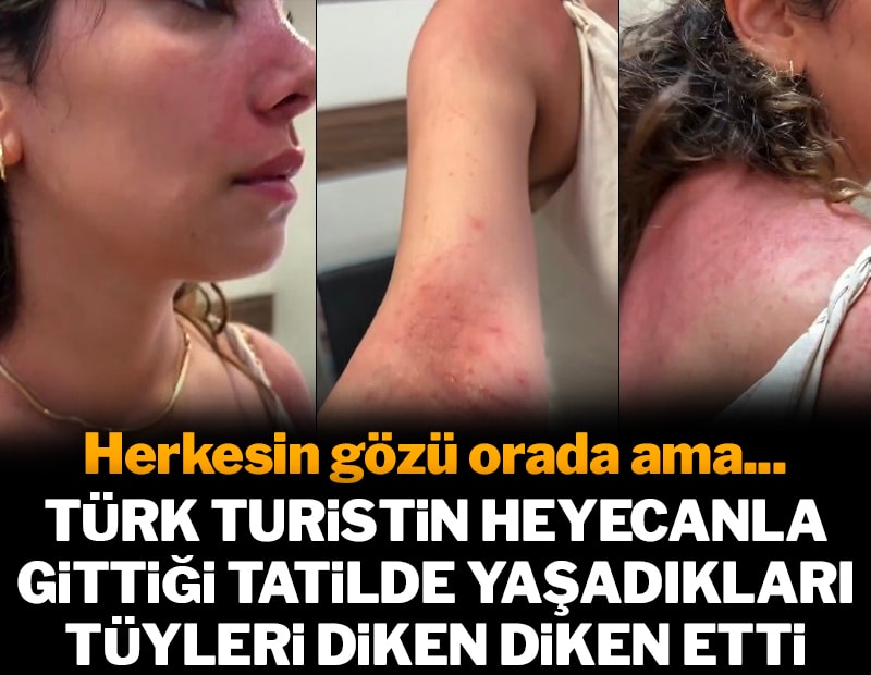 Herkesin gözü orada ama... Türk turist heyecanla gittiği tatilde yaşadıkları tüyleri diken diken etti