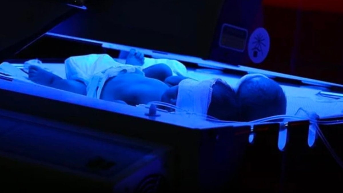 İstanbul'da kuvözde unutulan 17 günlük bebek yandı