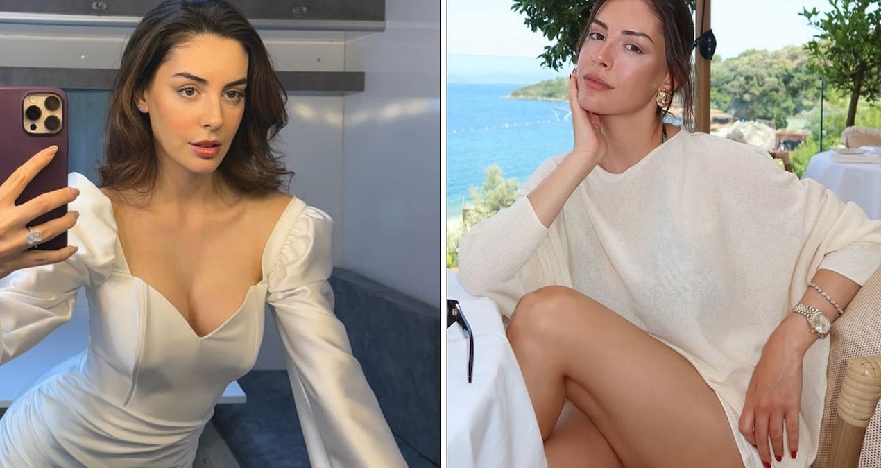 Kızılcık Şerbeti’nin Çimen’i estetik pişmanlığını açıkladı! Selin Türkmen dolgularını erittirdi