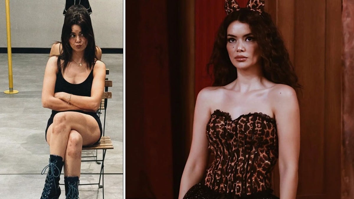 Direk dansı yapan ünlü oyuncunun dizleri bu hale geldi