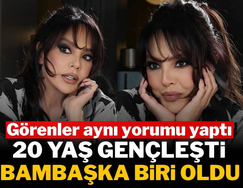 Estetik sonrası Ebru Gündeş’e yorum yağdı: “20 yaş daha genç görünüyor”