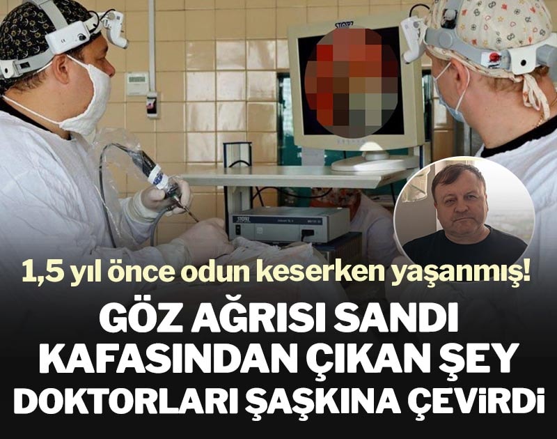 Göz ağrısı sandı, kafasından çıkan şey doktorları şaşkına çevirdi