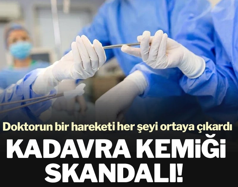 Kadavra kemiği skandalı! Doktorun bir hareketi her şeyi ortaya çıkardı