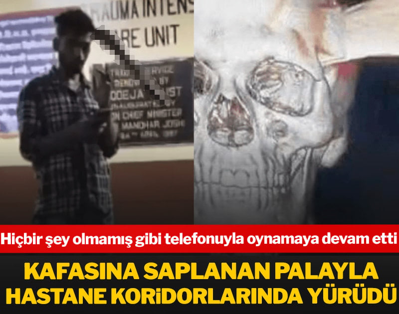 Kafasına saplanan palayla hastane acilinde telefonuyla oynadı