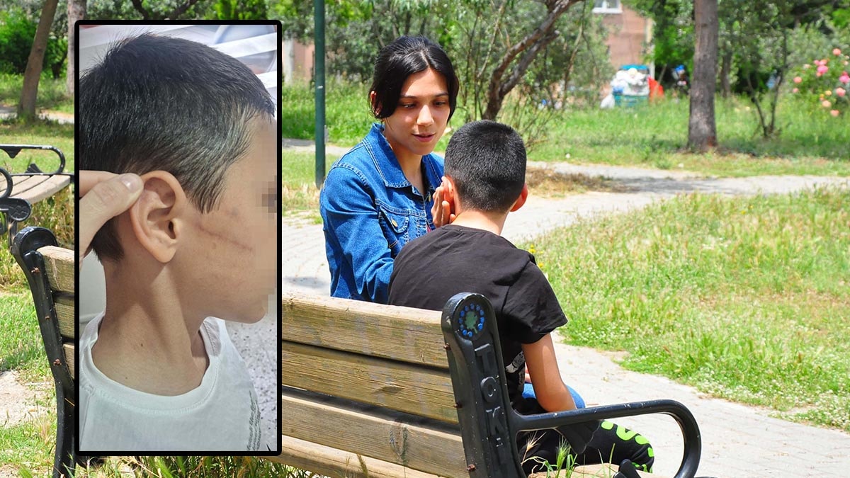 Vicdansız baba 12 yaşındaki oğlunu feci şekilde darp etti