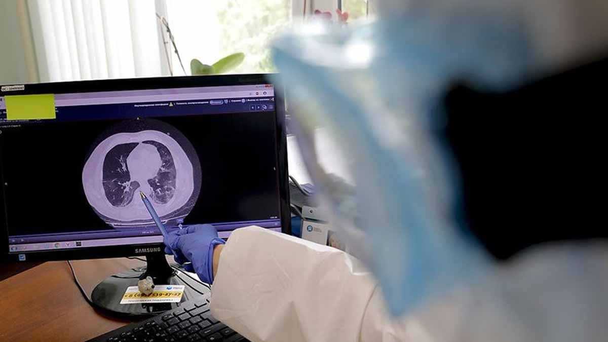 B12 vitamini için en iyi besin açıklandı