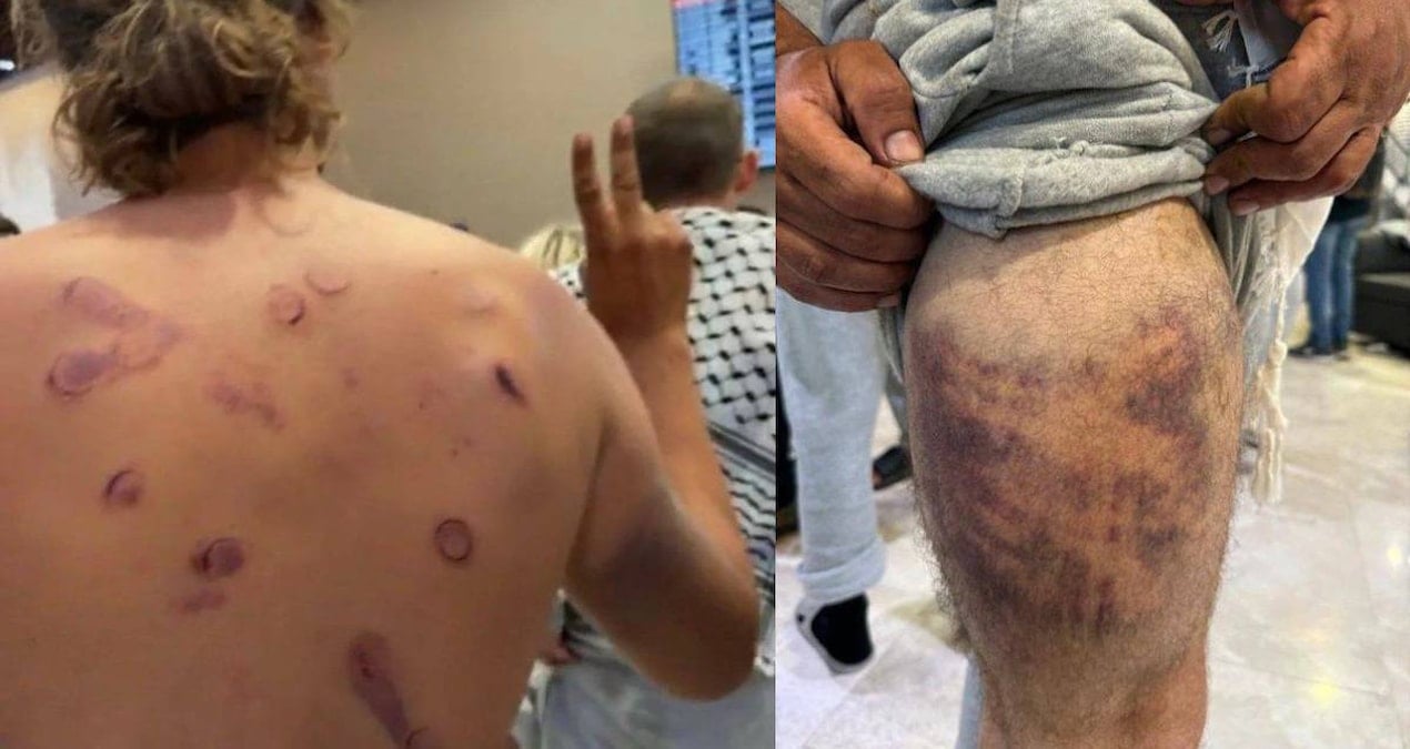 İsrail ordusu hakkında korkunç suçlama: Sumud filosu aktivistlerine tecavüz ettiler