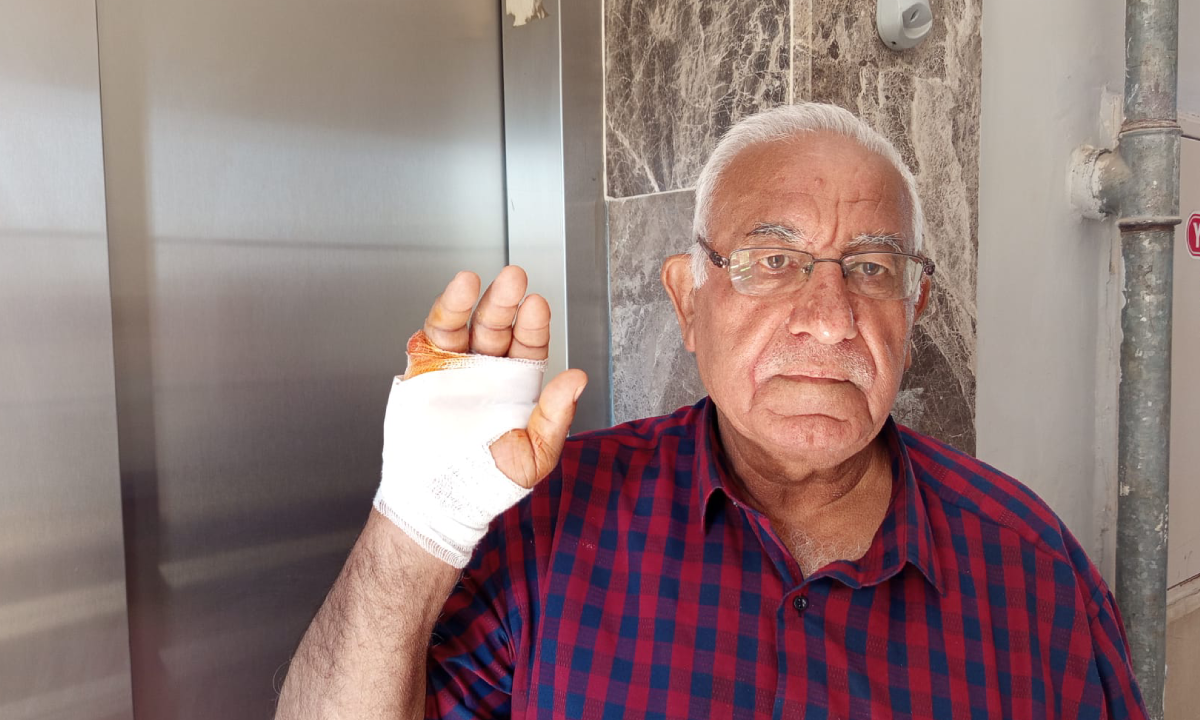 Çok sevdiği komşusu parmağını ısırarak kopardı