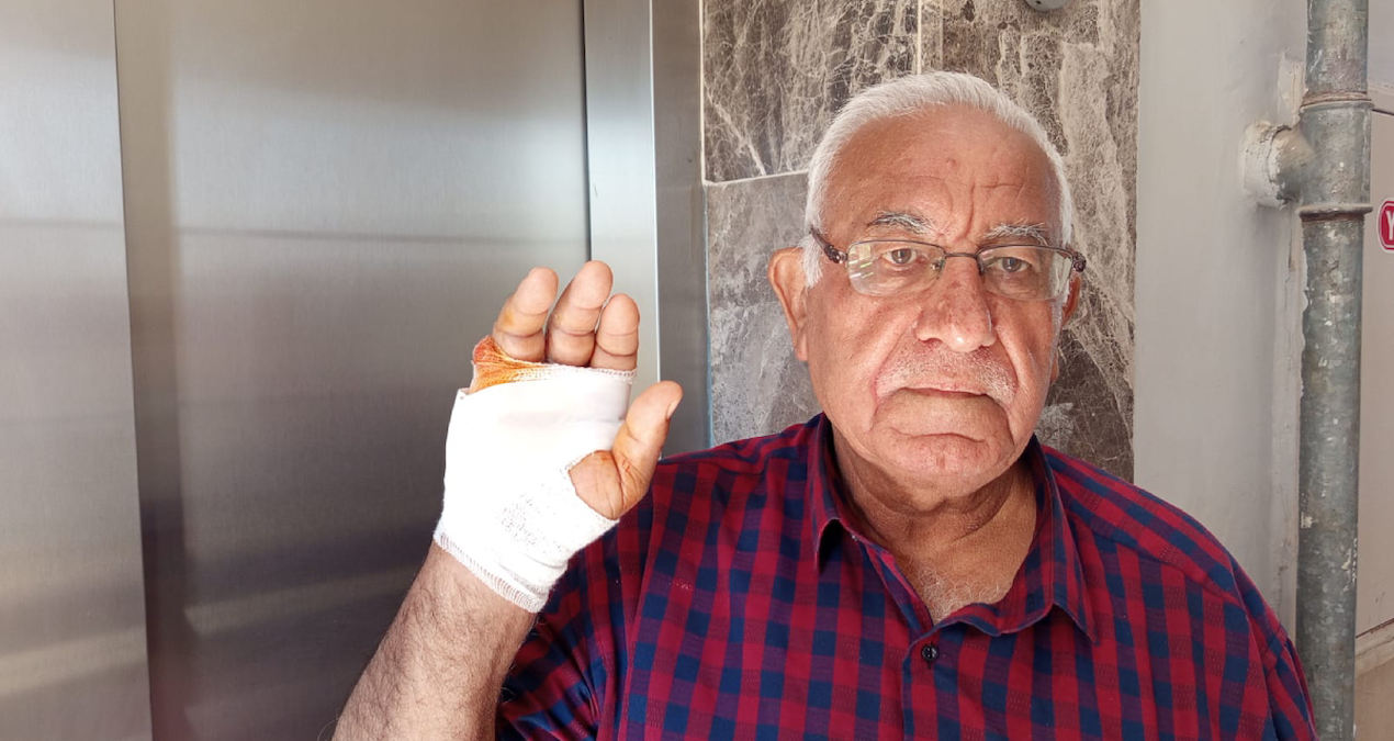 Hatay'da akılalmaz olay: Çok sevdiği komşusu parmağını ısırarak kopardı