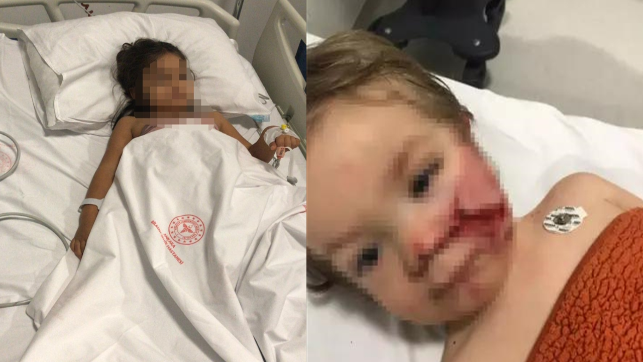 2 kardeşe felaketi yaşatan pitbullun sahibi tahliye edildi!