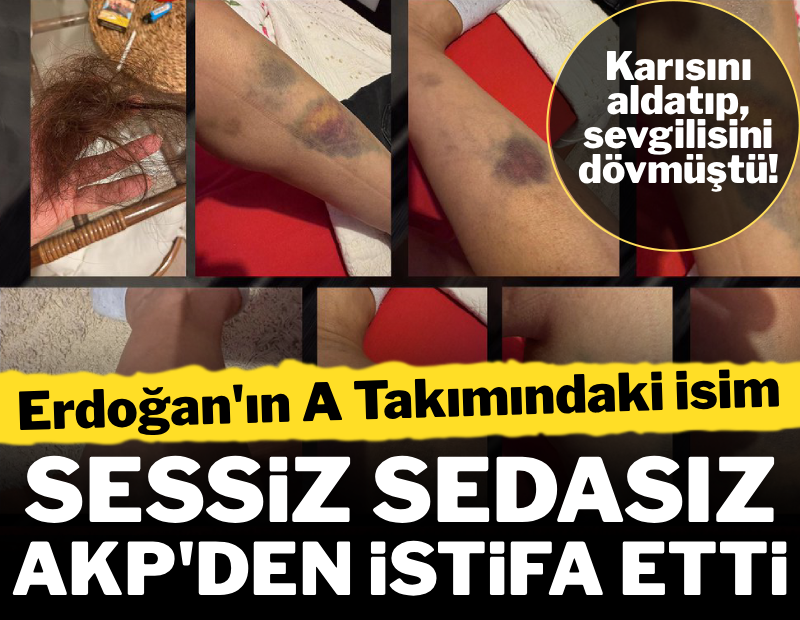 Karısını aldatıp sevgilisini dövmüştü! Sessiz sedasız AKP'den istifa ettirildi