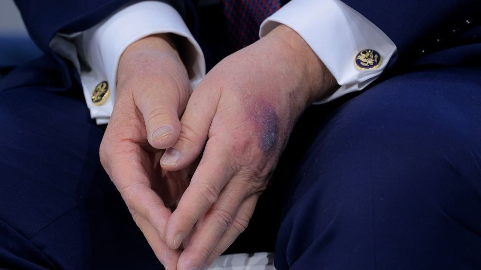 Trump'ın sağlık raporu tıp dünyasını böldü: Başkan durumunu saklıyor mu?