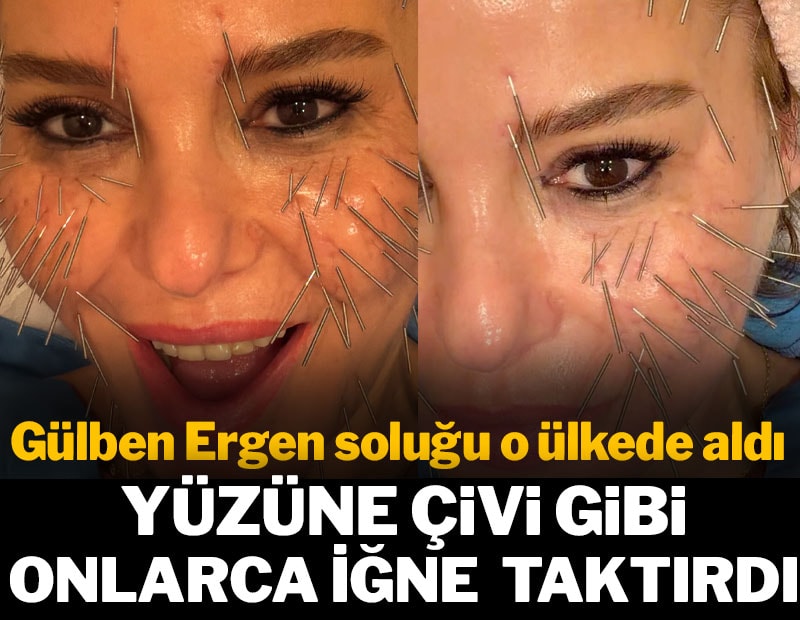 Yüzüne çivi gibi iğneler taktırdı: Gülben Ergen bu hale geldi