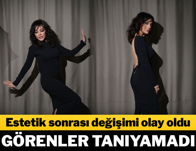 Ünlü sanatçı son haliyle sosyal medyayı salladı