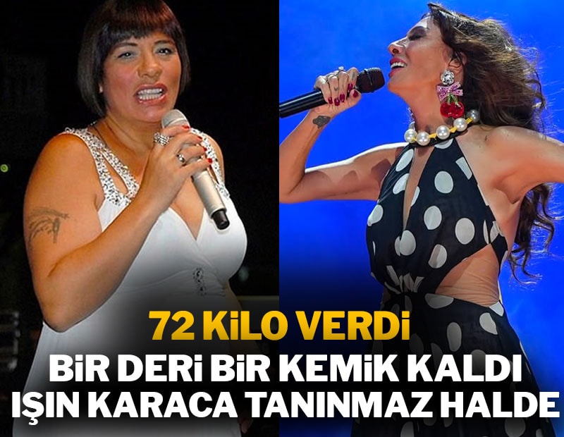 Bir deri bir kemik kaldı: İşte Işın Karaca'nın son hali