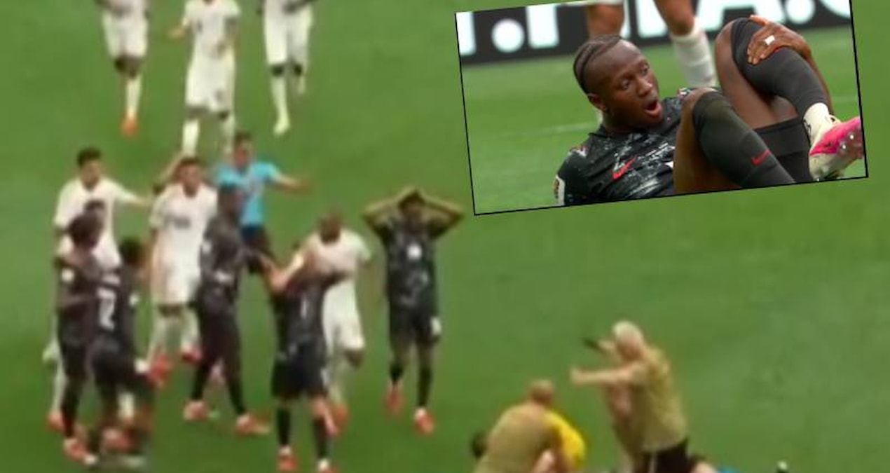 Dünya Kupası’nda büyük şok! Kanadalı futbolcunun ayağı kırıldı