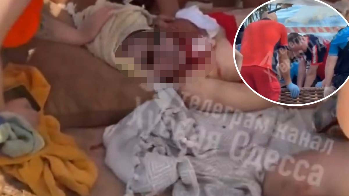 Odessa’da plajda güneşlenen kadın Rusya’nın dron saldırında öldü