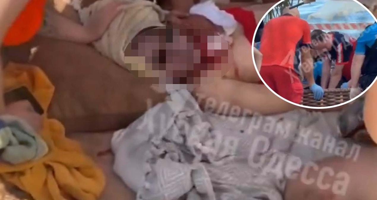 Odessa’da plajda güneşlenen kadın Rusya’nın dron saldırında öldü