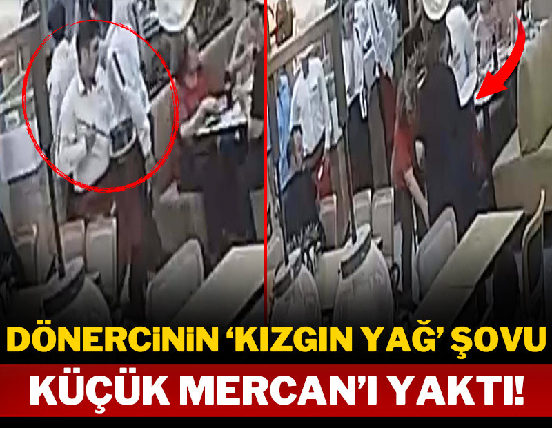 Dönercinin kızgın yağ şovu küçük Mercan'ı yaktı!